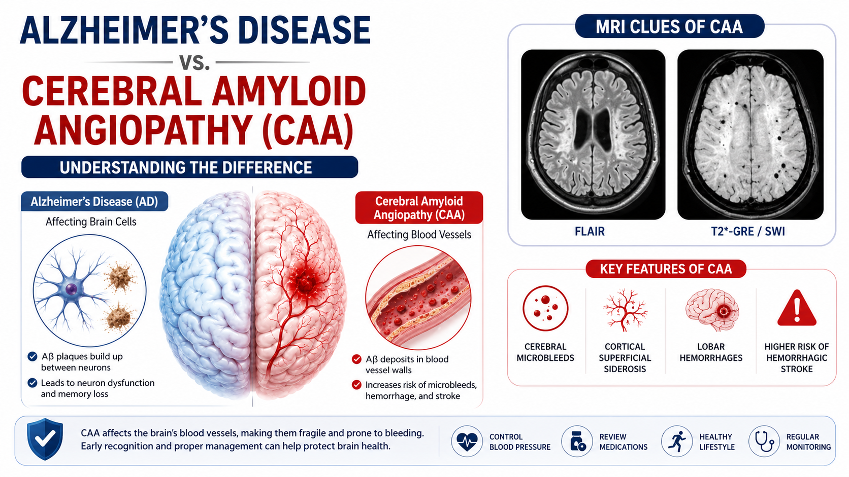 Caa Protection Cerebral Amyloid Angiopathy (CAA): A Clear Guide to Symptoms, Risks ...