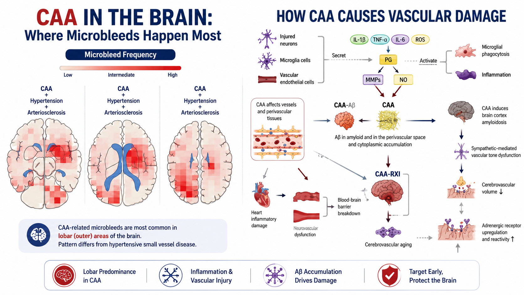 What Causes Cerebral Amyloid Angiopathy (CAA)? Understanding the Build ...