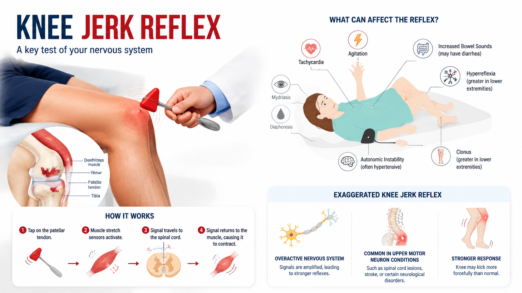 What is Hyperreflexia? A Clear Guide to Overactive Reflexes and Nerve ...