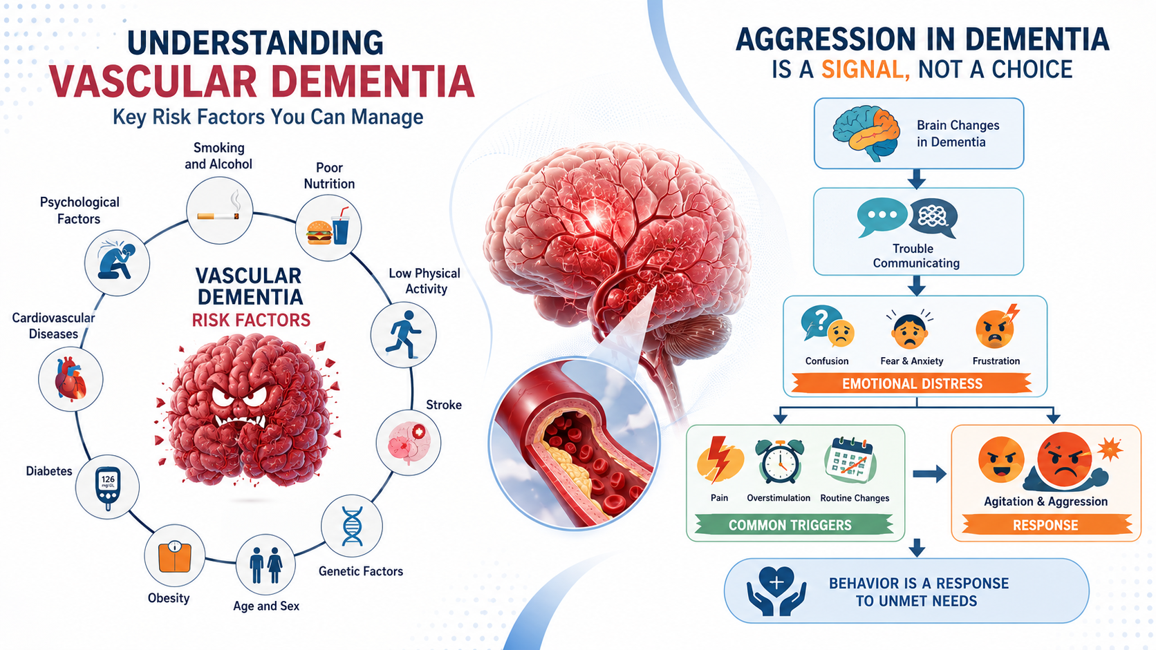 Vascular Dementia: A Comprehensive Guide to Understanding and Managing ...